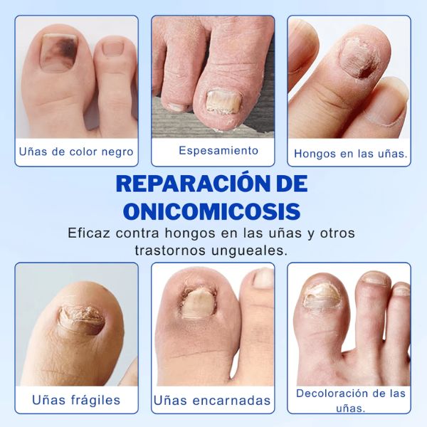 Cuida la apariencia de tus uñas mientras duermes, sin cremas, líquidos ni rutinas complicadas