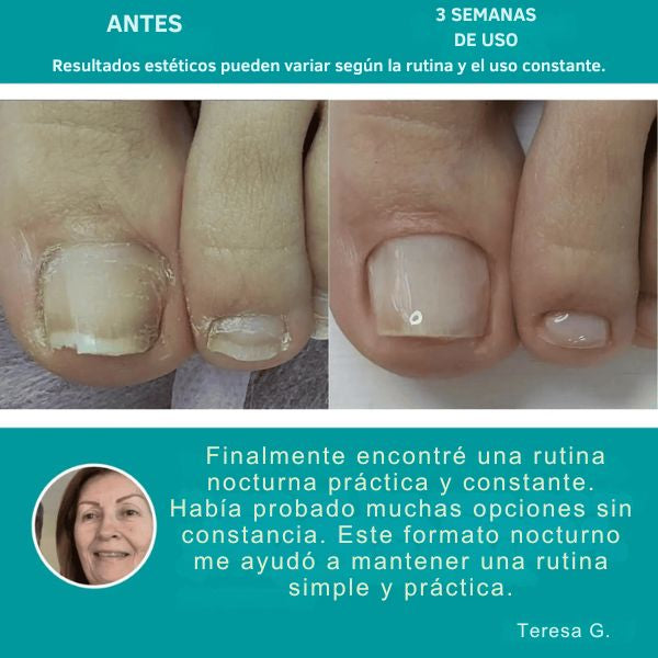 Cuida la apariencia de tus uñas mientras duermes, sin cremas, líquidos ni rutinas complicadas